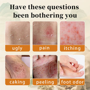 Ungüento Baicao Puro y Natural OEM/ODM, Ungüento Antiinflamatorio y Antibacteriano para la Piel, Ungüento para Dermatitis 20g, Venta Caliente - Product Image 4