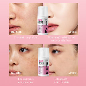 <span class=keywords><strong>Crema</strong></span> Facial Eliminadora de Manchas Oscuras TWG OEM, Antipecas, Niacinamida Hidratante, Elimina Melasma, Corrector de Manchas Oscuras, <span class=keywords><strong>Crema</strong></span> Blanqueadora - Product Image 6