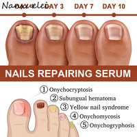 Sérum réparateur d'ongles Jaysuing de haute qualité et efficace, 7 jours, ingrédients à base de plantes, sérum réparateur d'ongles