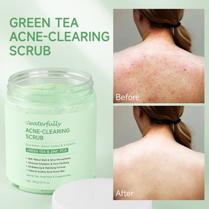 Gommage corporel anti-acné à marque privée au thé vert et zinc PCA, exfoliant, nettoyant les pores et lissant, 3 Gommages Naturels - Product Image 1