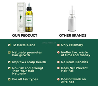 Huile de Romarin Naturelle Personnalisée aux Herbes, Biotine Nourrissante et Stimulante pour la Repousse des Cheveux, Produits de Croissance Capillaire à Marque Blanche