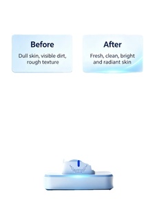 เครื่องนวดหน้าแบบพกพา 3 in 1 พร้อมฟังก์ชั่น CO2 บับเบิ้ล ยกกระชับใบหน้าและลำคอ ผลัดเซลล์ผิว ปรับผิวกระจ่างใส และขัดผิวด้วยระบบเดอร์มาเบรชั่น - Product Image 6