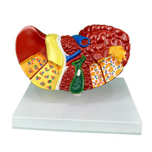 Modèle d'anatomie hépatique pathologique Structure hépatique malade avec cirrhose et lésions tumorales pour l'enseignement médical et la formation chirurgicale - Product Image 2