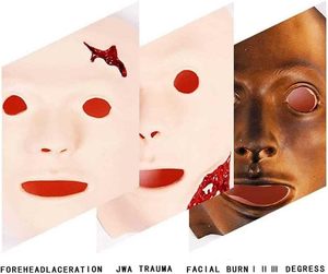 Maniquí de enseñanza médica Módulo de cuidado de traumatismos y quemaduras de 16 componentes Simuladores de quemaduras faciales y heridas Modelo de evaluación de traumatismos - Product Image 2