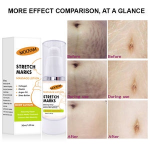 Rimuovere le smagliature <span class=keywords><strong>crema</strong></span> Anti rughe bellezza sbiancamento della pelle riparazione della cicatrice smagliature <span class=keywords><strong>crema</strong></span> per la gravidanza - Product Image 5