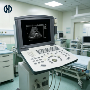 Appareil d'échographie numérique portable noir et blanc avec traitement d'image avancé <span class=keywords><strong>pour</strong></span> un diagnostic clinique vétérinaire clair - Product Image 1