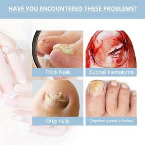 Sérum de croissance et de réparation des ongles OceAura, solution de traitement rapide pour renforcer et nourrir les ongles des mains et des pieds - Product Image 3