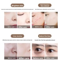 Appareil de gestion de la peau Black Pearl, nettoyage du visage, injection d'oxygène à bulles d'hydrogène-oxygène, équipement de salon de beauté