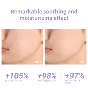 Tónico Facial LANBENA de Alta Calidad para Control de Grasa, Reparación de la Piel, Hidratación y Calmante - Product Image 6