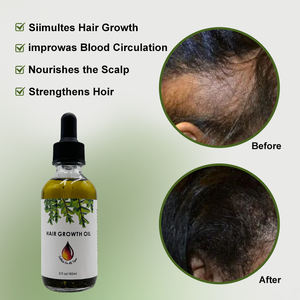 Pakistan indische Öle Name Massage für Männer Kerala vegan chinesische Bio-Kokosnuss Zöpfe mit Biotin natürlichen Haarwuchs öl - Product Image 2