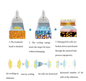 Professional 360 <strong>Cryolipolysis</strong> Therapy New <strong>Cryolipolysis</strong> Cool Shaping Cryo Lose Weight <strong>Cryolipolysis</strong> Machine - Product Image 4