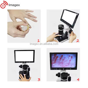 Instrument optique de capillaroscopie de la pliure unguéale pour le diagnostic en rhumatologie et le dépistage des maladies auto-immunes - Product Image 5