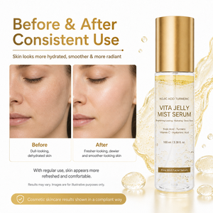 Sérum en Brume Hydratant et Éclaircissant au Curcuma et à l'Acide Kojique OEM ODM – Brume Faciale Rafraîchissante - Product Image 5