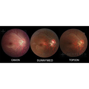 معدات العيون ، آلة اختبار العين الرقمية Retin ، للبيع - Product Image 2