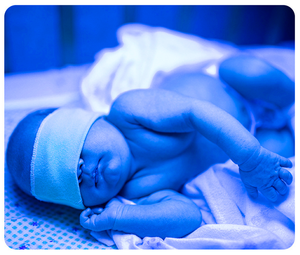 หลอดไฟ LED สำหรับการรักษาโรคดีซ่านในทารกแรกเกิด ความยาวคลื่น 420-460 นาโนเมตร แบบตั้งพื้น แสงสีฟ้า - Product Image 5