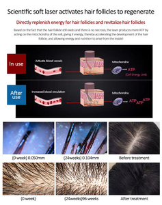 Appareil multifonctionnel de soin du cuir chevelu et de traitement de repousse des cheveux avec stylo dermique, pistolet pulvérisateur pour l'inspection du cuir chevelu et la lutte contre la chute des cheveux, idéal pour usage en salon - Product Image 5