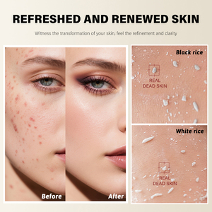 <span class=keywords><strong>Exfoliante</strong></span> <span class=keywords><strong>Facial</strong></span> Ampolla <span class=keywords><strong>Exfoliante</strong></span> Suave de Arroz Blanco y Negro, Suero <span class=keywords><strong>Facial</strong></span> para Eliminar Células Muertas de la <span class=keywords><strong>Piel</strong></span> y Puntos Negros, Cuidado <span class=keywords><strong>Facial</strong></span> - Product Image 6