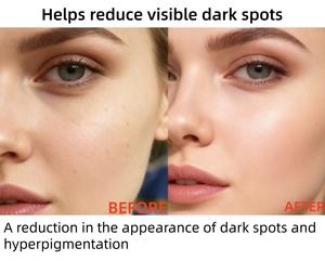 Suero de azafrán Iluminador Alternativo Vitamina C <span class=keywords><strong>Para</strong></span> <span class=keywords><strong>manchas</strong></span> <span class=keywords><strong>oscuras</strong></span> e hiperpigmentación Antioxidante Piel radiante y saludable - Product Image 6