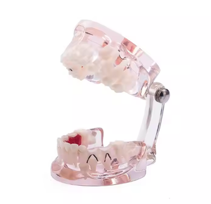 Modello Didattico per Igiene Orale Gelsonlab HSBM-447, Modello per Pulizia dei Denti, Grande Modello Dentale con 32 Denti - Product Image 6