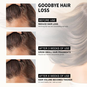 Esencia de aceite nutritivo calmante para el cuero cabelludo, hace que el cabello sea más saludable - Product Image 4