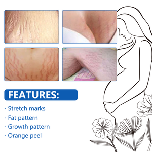 Meilleures ventes de traitement de la peau <span class=keywords><strong>anti</strong></span>-vergetures <span class=keywords><strong>produit</strong></span> d'huile pure et naturelle d'élimination des vergetures pour la grossesse - Product Image 2