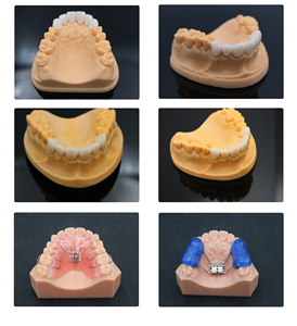 Impresoras 3D de Resina Imprimen Guías de Implantes de Alta Precisión Moldes de <span class=keywords><strong>Ortodoncia</strong></span> Invisibles para Clínica Dental Resinas Biocompatibles de Soporte - Product Image 3