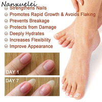 Sérum réparateur d'ongles Jaysuing de haute qualité et efficace, 7 jours, ingrédients à base de plantes, sérum réparateur d'ongles
