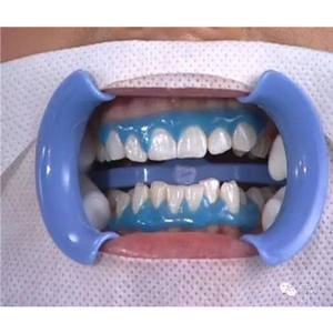 <span class=keywords><strong>Gel</strong></span> Blanqueador Dental de 3 ml, Nuevo, para Dientes, Blanqueamiento Dental, Barrera <span class=keywords><strong>Gingival</strong></span>, Previene Alergias - Product Image 4