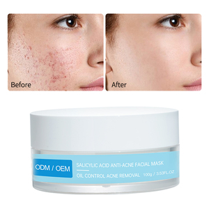 OEM Ácido salicílico Eliminación de espinillas Facial AHA Basado Exfoliante Peeling Anti Tratamiento Mascarilla facial Ácido salicílico Mascarilla de gelatina - Product Image 4