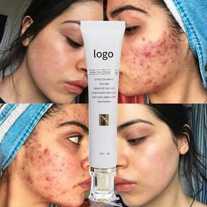 Nuevos Productos en Oferta, Crema para el Cuidado de Cicatrices, Crema Facial Orgánica con Manteca de Karité - Product Image 2