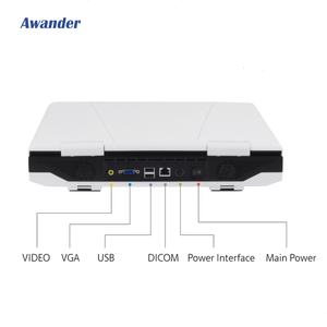 Scanner à ultrasons de grossesse pour chien vétérinaire Scanner à ultrasons avec sonde micro-convexe Chiens Machine de contrôle de grossesse - Product Image 4