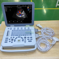 Promotion : Sonographe Doppler Portable pour Animaux – Échographe USG pour Bétail et Animaux de Compagnie avec Sonde d'Examen