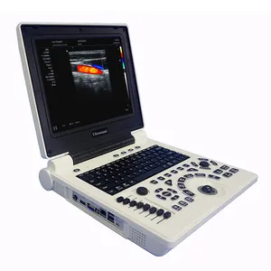 笔记本电脑4D彩色多普勒超声扫描仪医用便携式人体超声扫描仪价格