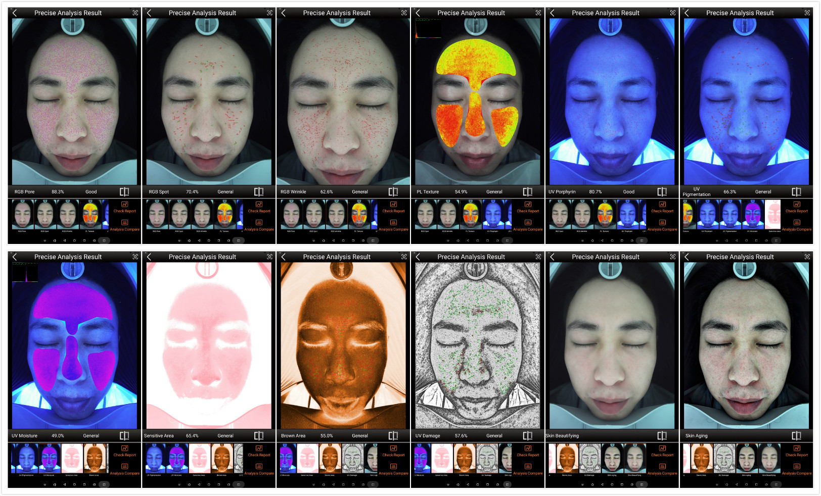Magic Mirror digital Skin Analyzer for beauty salon/ Dermatologists