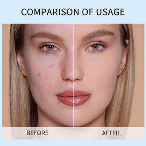 Vendita calda per la cura della pelle aminoacidi <span class=keywords><strong>detergente</strong></span> Peeling <span class=keywords><strong>Gel</strong></span> idratante esfoliante pelle morta rimozione viso <span class=keywords><strong>Gel</strong></span> - Product Image 4