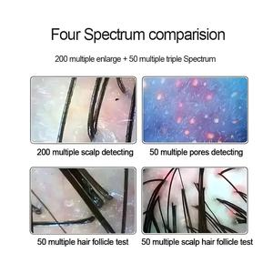 Analyseur de peau numérique professionnel de 15 pouces, caméra pour cuir chevelu, appareil de test pour follicules pileux, huile et humidité - Product Image 6