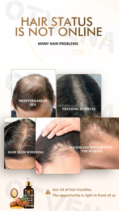 OTVENA <span class=keywords><strong>Olio</strong></span> di Cocco 100% Biologico per Riparazione Profonda e Lisciatura dei Capelli Secchi e Ricci, Prevenzione Caduta Capelli, 4 Settimane, 20ml - Product Image 4