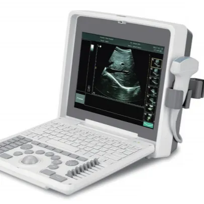Цифровой ультразвуковой аппарат по заводской цене, usg, портативный ноутбук, диагностический медицинский сканер, ультразвуковая система для людей, цена
