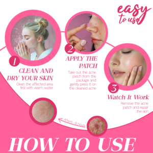 Mới đến long lanh mụn vá bướm hình dạng Blemish vá Hydrocolloid tì vết dán long lanh mụn vá - Product Image 6