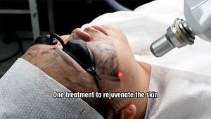 Máy Xóa Hình Xăm Laser Picosecond Nd Yag Chuyển Mạch Q Picosecond Di Động Laser Pico Xóa Nếp Nhăn Làm Trắng Da - Product Image 6