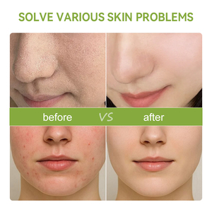 <span class=keywords><strong>Crema</strong></span> <span class=keywords><strong>Viso</strong></span> Idratante Biologica Post-Sole Anti-Rughe all'Aloe Vera con Etichetta Privata - Product Image 5