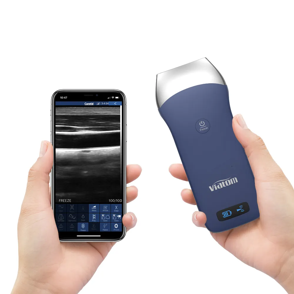 Viatom 128 elemanları kablosuz ultrason doğrusal prob 7.5/10MHz el ultrason taşınabilir
