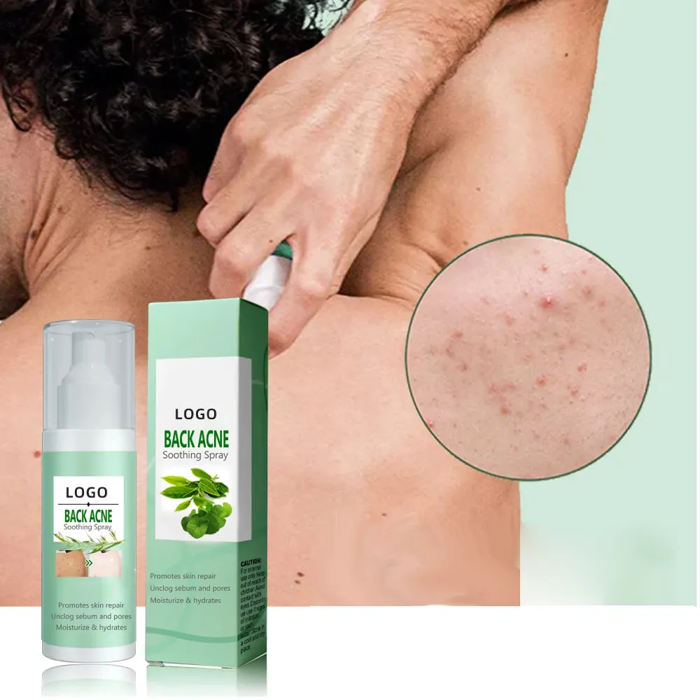 Private Label Anti Acne Spray Free Sample Skin Toner Tea Tree Salicylic Acid Treatment Effective Back Acne Remover Custom Logo