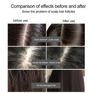 Analyseur <span class=keywords><strong>de</strong></span> cuir chevelu, <span class=keywords><strong>de</strong></span> cheveux et <span class=keywords><strong>de</strong></span> peau avec technologie intelligente IA, <span class=keywords><strong>massage</strong></span> par vibration, analyse faciale - Product Image 4