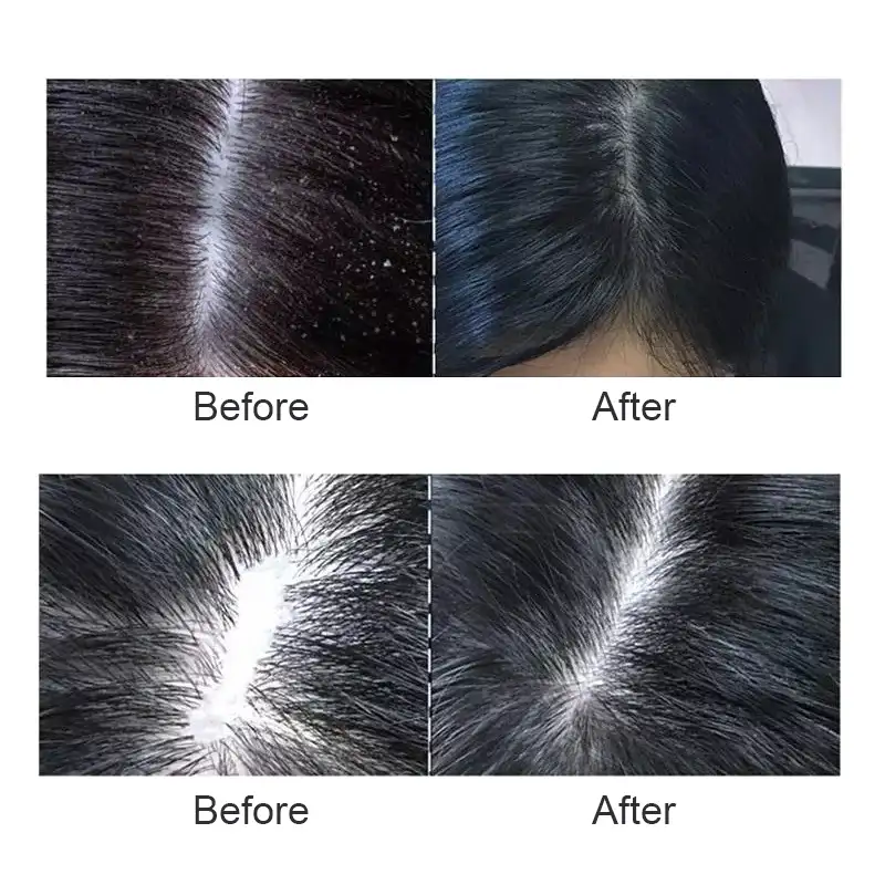 नई आगमन 60ml विरोधी बालों के झड़ने उपचार बायोटिन बाल विकास सीरम