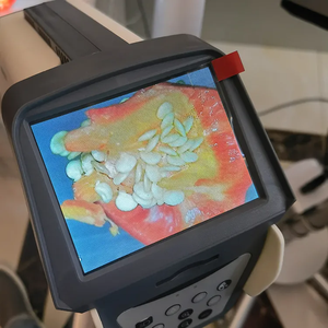 Chất lượng cao phụ khoa dụng cụ c6hd phụ khoa kiểm tra <span class=keywords><strong>video</strong></span> <span class=keywords><strong>colposcope</strong></span> âm đạo nội soi phụ khoa <span class=keywords><strong>colposcope</strong></span> - Product Image 3