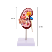 Modelo de Riñón Patológico y Normal - Simulación de Enseñanza de Urología, Modelo de Anatomía y Estructura del Riñón Humano