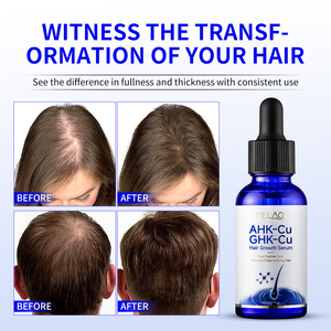 Complejo de Péptidos de Cobre Vegano Orgánico para Revitalización Folicular, Fortalecimiento de la Raíz, Cuidado del Cuero Cabelludo de Rápida Absorción, 2 en 1, Crecimiento del Cabello - Product Image 3