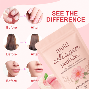 Collagène en poudre de marque privée, peptides de protéines multi-collagènes en poudre, acide hyaluronique, supplément de vitamine C, beauté, peau, cheveux, croissance - Product Image 4