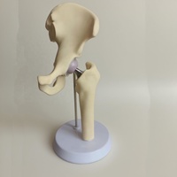 Implant de hanche, remplacement d'articulation artificielle, taille réduite, os artificiel certifié CE/ISO